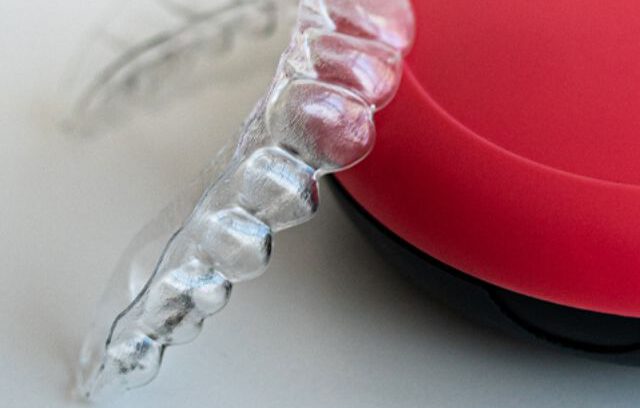 Ortodoncja w&nbsp;Gabinetach Tuwima